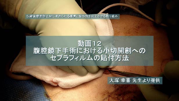 腹腔鏡下手術における小切開創へのセプラフィルムの貼付方法
