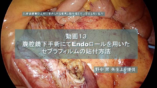 腹腔鏡下手術にてEndoロールを用いたセプラフィルムの貼付方法