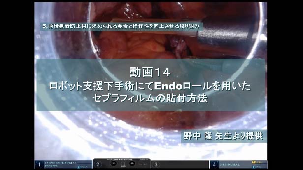 ロボット支援下手術にてEndoロールを用いたセプラフィルムの貼付方法