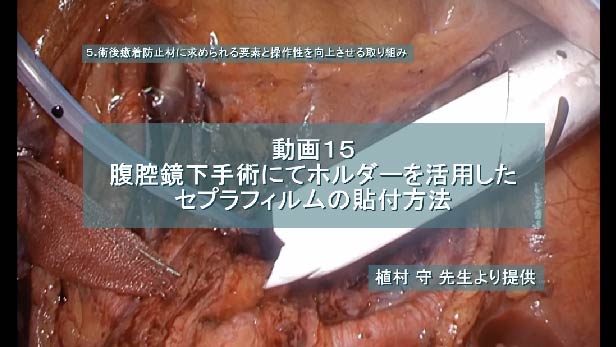 腹腔鏡下手術にてホルダーを活用したセプラフィルムの貼付方法